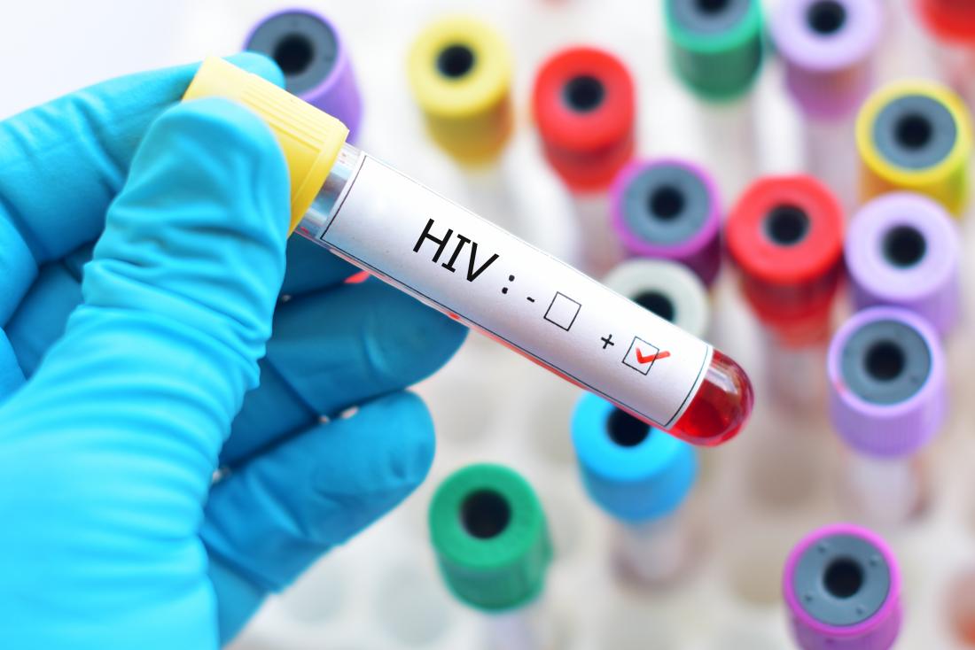 Monitoring of immunovirological response and HIV-1 drug resistance amongst adolescents on antiretroviral therapy in two reference paediatric centres in Yaounde